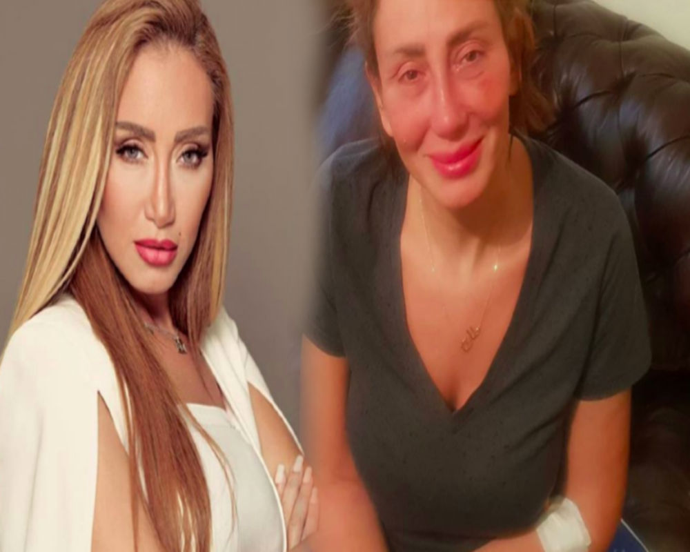 صورة ريهام سعيد تصرح: أزلت أنفي بالكامل