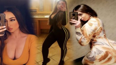 صورة بسبب عملية تجميل فاشلة.. عارضة أزياء ممنوعة من الجلوس لمدة 6 أشهر