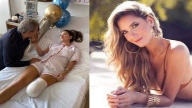 صورة صادم.. ملكة جمال توافق على بتر رجلها – صور