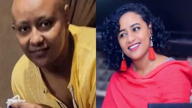 صورة ظهرت حليقة الرأس.. تعاطف كبير مع فنانة مصابة بالسرطان