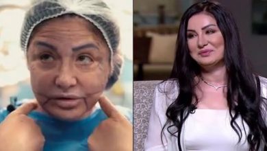صورة فنانة عربية تكشف تفاصيل تعرض وجهها للتشوه