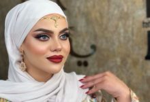صورة تغيرت ملامحها بشكل ملحوظ.. سارة الركراكي تكشف عن معاناتها -صورة