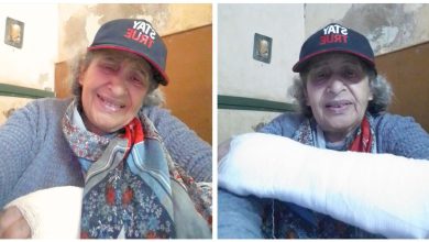 صورة بعد طلبها شقة.. عائشة ماهماه تتعرض لإصابة