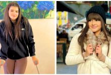 صورة لينا أكدور تطمئن جمهورها بعد تعرضها لإصابة في القدم -فيديو