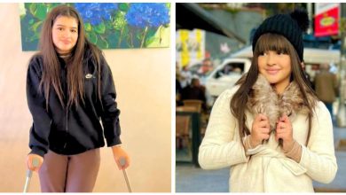 صورة لينا أكدور تطمئن جمهورها بعد تعرضها لإصابة في القدم -فيديو