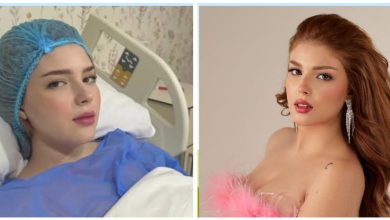 صورة وجدان سعيد تواجه مشكلة في المعدة وتوضح سبب العملية