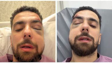 صورة أحمد الصابيري يخضع لعملية جراحية بعد تعرضه لحادث سير -فيديو