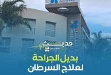 صورة بديل الجراحة لعلاج السرطان -فيديو